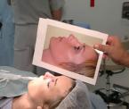 deviated septum treatment