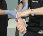 how to splint a broken arm