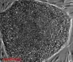 human embryonic stem cells