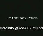 body tremors movement disorder