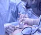 minimally invasive procedures available
