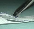 custom made stent