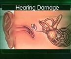 protecting hearing from chemo