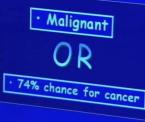 reducing unnecessary biopsies