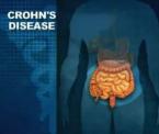 natural healing for crohns disease