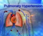 breakthrough for fatal lung disease