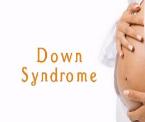 learn about down syndrome
