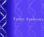 learn about turner syndrome