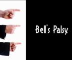 learn about bells palsy