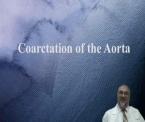 learn about aortic coarctation