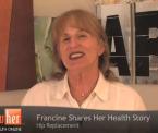 driving after hip replacement surgery francines story