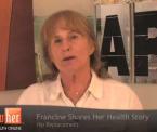 choosing a physical therapist after hip replacement francines story