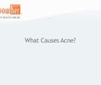 the causes of acne