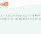what balloon sinuplasty is