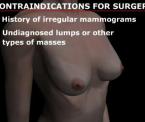 learn about breast reduction