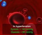 learn about hypertension