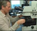 stem cells neurological treatments