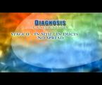 surviving breast cancer a disease of all women