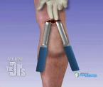 how calf implants work