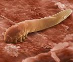 eyelash mites