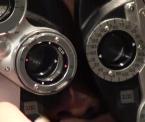 eye laser surgery