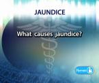 learn about jaundice in new born
