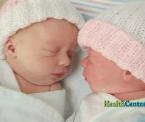 laser surgery saves twins