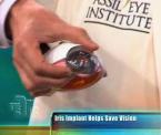 explaining the iris implant