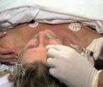 nick tuck facelift surgery