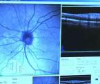 performing a glaucoma test