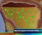 the dangers of holding in urine