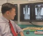 genetic test for scoliosis
