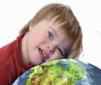 downs syndrome childrens vision problems