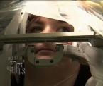 inside alexs deep brain stimulation surgery