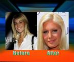 heidi montags plastic surgery overkill