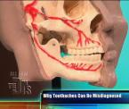 the connection between a toothache and sinusitis