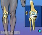 alternatives to knee replacement surgery