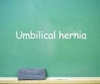 umbilical hernia in newborns