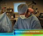 the scarless sils hysterectomy option