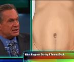 what happens during a tummy tuck