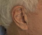 hearing loss diagnosis and treatments