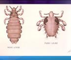 head lice vs pubic lice