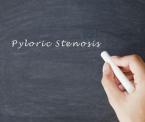pyloric stenosis in newborns