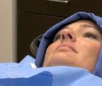 dawns water assisted liposuction surgery