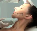 skin tightening procedures