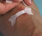how to make a butterfly bandage