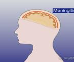 meninges and meningitis explained