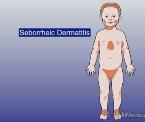 seborrheic eczema in children