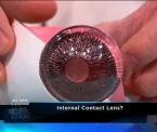 what are implantable contact lenses