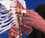 how a titanium rib straightens clays spine